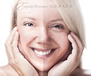 stock image of a woman smiling for a blog about non-invasive laser treatments for skin rejuvenation