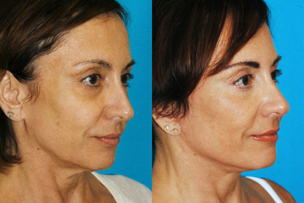 Thousands of Happy Patients From Central Jersey and Beyond