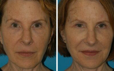 One 68-Year-Old Woman’s Story of A Natural Beauty Transformation