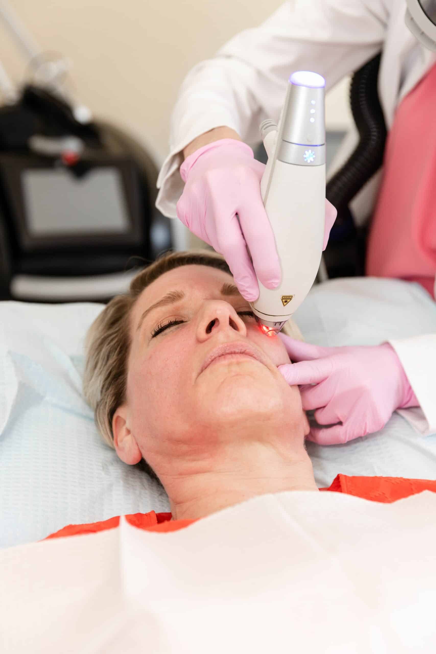 Skin rejuvenation laser treatment procedure in NJ