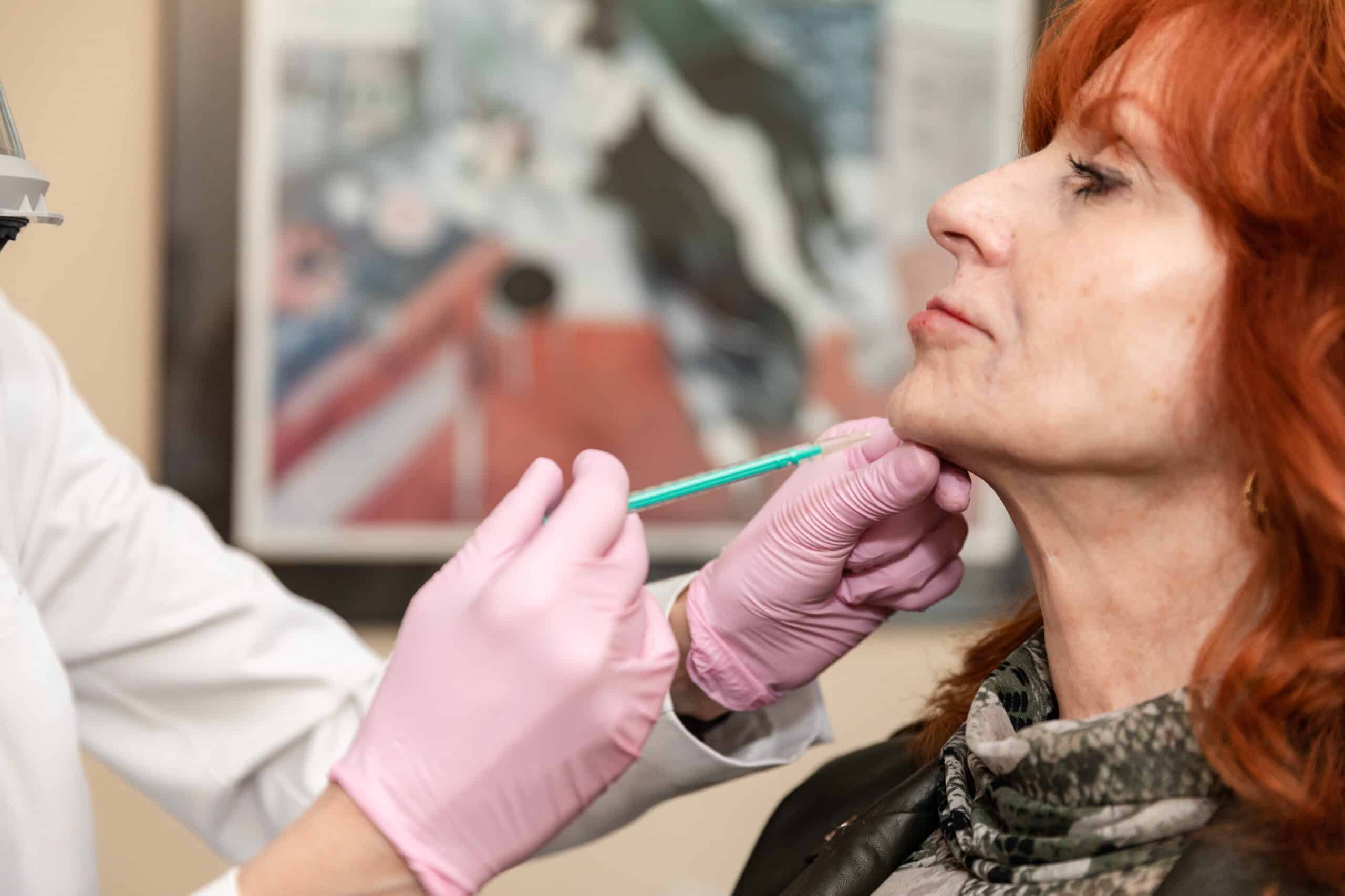 dermal fillers for scar treatment - Princeton - NJ patient receiving dermal fillers for scar treatment in Princeton, NJ
