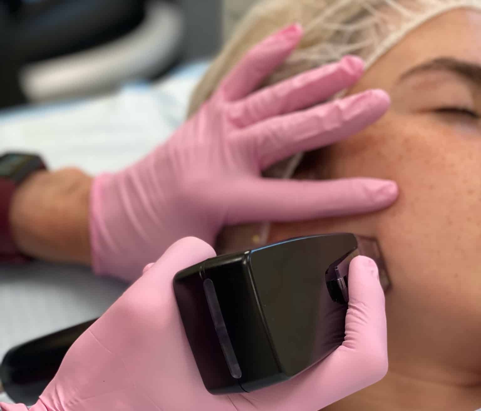 brunner-princeton-nj-morpheus8-procedure fractora non surgical skin tightening in priceton nj