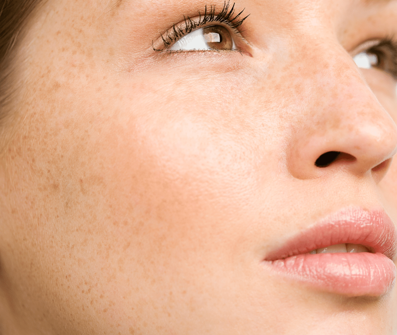 eugenie-brunner-princeton-nj-juvederm-skinvive skin after skinvive injections