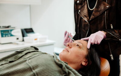 Radiesse® vs Sculptra®: Choosing the Right Collagen Stimulating Filler for Long Lasting Results