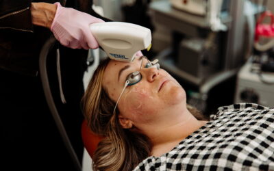 Ablative vs Non-Ablative Laser: What Is the Difference?