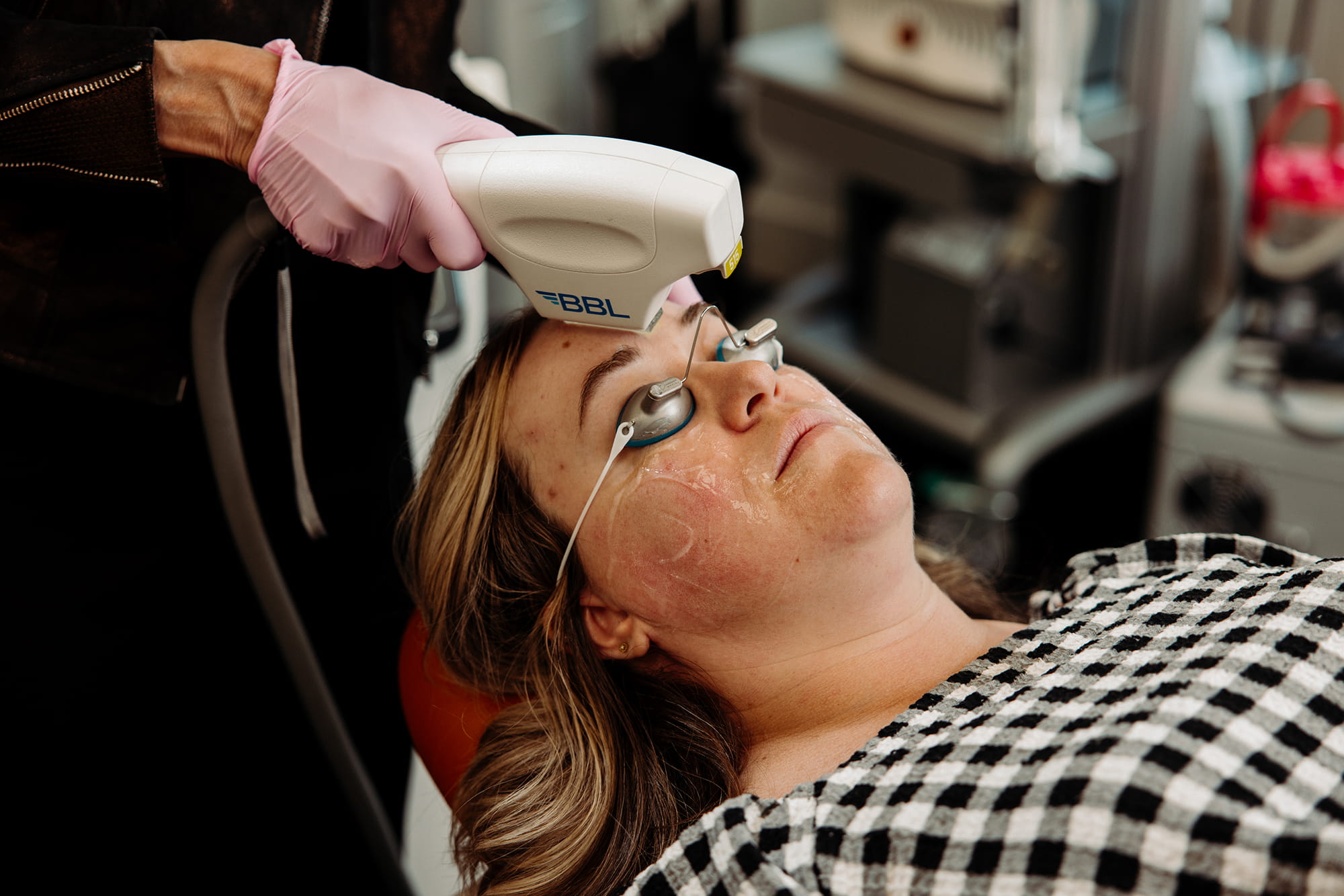 Ablative vs Non-Ablative Laser: What Is the Difference?