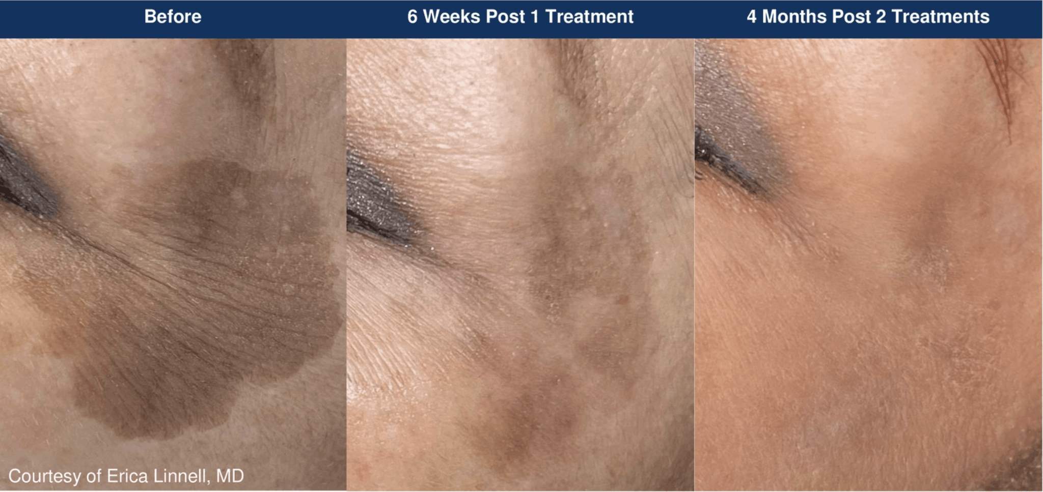 Clear before and after photos