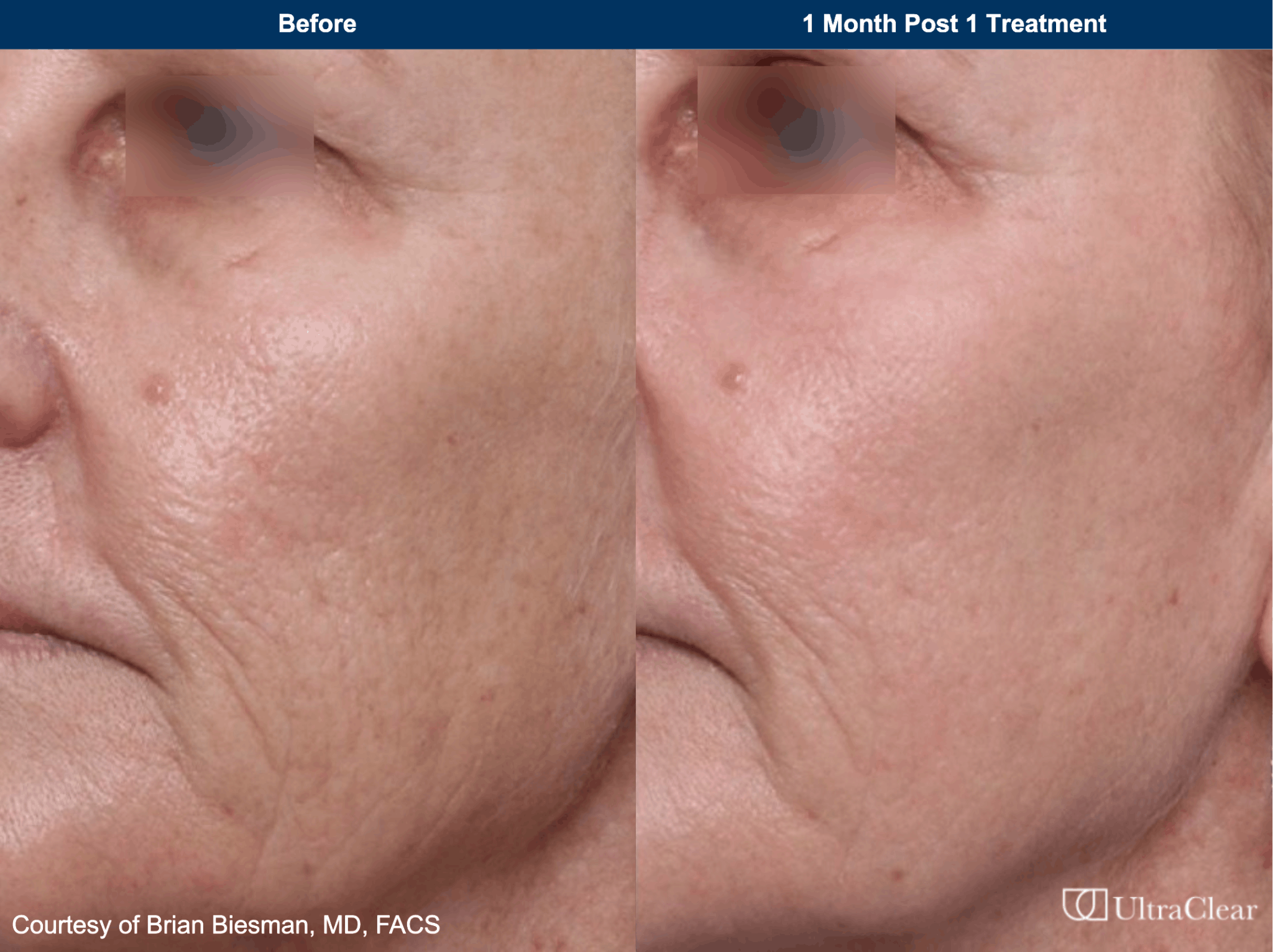 Customized treatment before and after photo